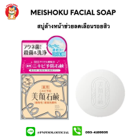 Acne Soap สบู่ลดเลือนรอยสิว จางไว​ สิวใหม่​ ยุบง่าย​