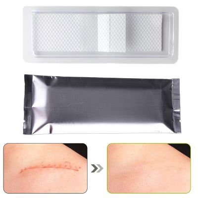 ♦ Reusable Scar Removal Sheet 12CM Breathable Silicone Patch For C-Section Surgical Burn Acne Scars Keloid Post-Acne Stretch Marks