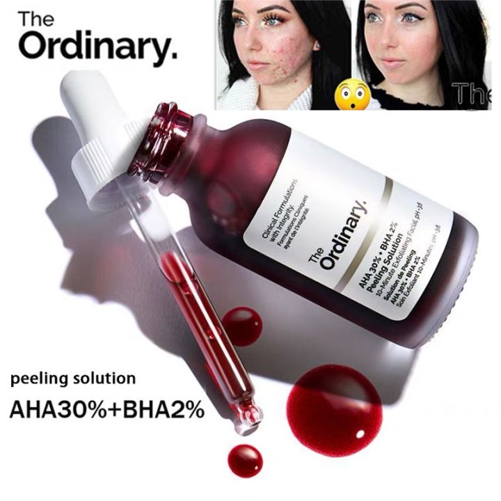 the-ordinary-aha-30-bha-2-30ml-เซรั่มลดสิ-รักษาสิวอุดตัน-ลดสิว-รอยสิว-เซรั่มรักษาสิว-เซ-รั่มรักษาสิว-ครีมลดสิว-สิวหัวดำ-กำจัด