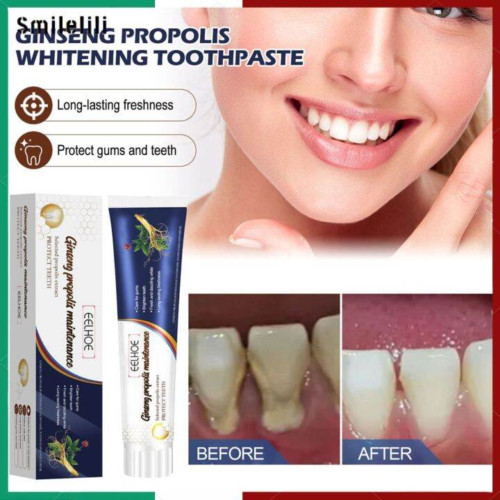 [Smilelili] EELHOE Ginseng Propolis White Toothpaste Cleaning Tooth ...