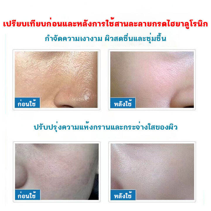 สินค้าขายดี-เซรั่ม-เข้มข้น-เน้น-ขาว-ใส-กระชับ-รูขุมขน-hydration-moisturizing-serum-ขนาด-100-ml-กำจัดจุดด่างดำ-เอสเซ้นส์ต่อต้านกระ-เซรั่มบำรงหน้า-เซรั่มหน้าใส-เชรั่มหน้าใส-เซรั่มไวท์เทนนิ่งและกระ-เอสเซ