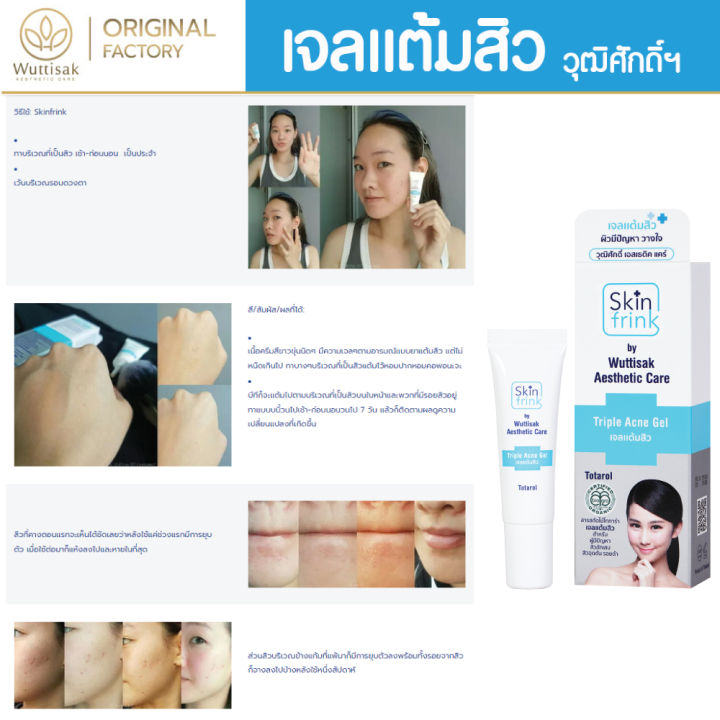 ส่งไว-เจลแต้มสิว-สกินฟริ้งค์-ทริปเปิ้ล-แอคเน่-เจล-skin-frink-acne-gel-ส่งตรงจากโรงผลิตในไทย-เจ้าของขายเอง-ถูกที่สุด