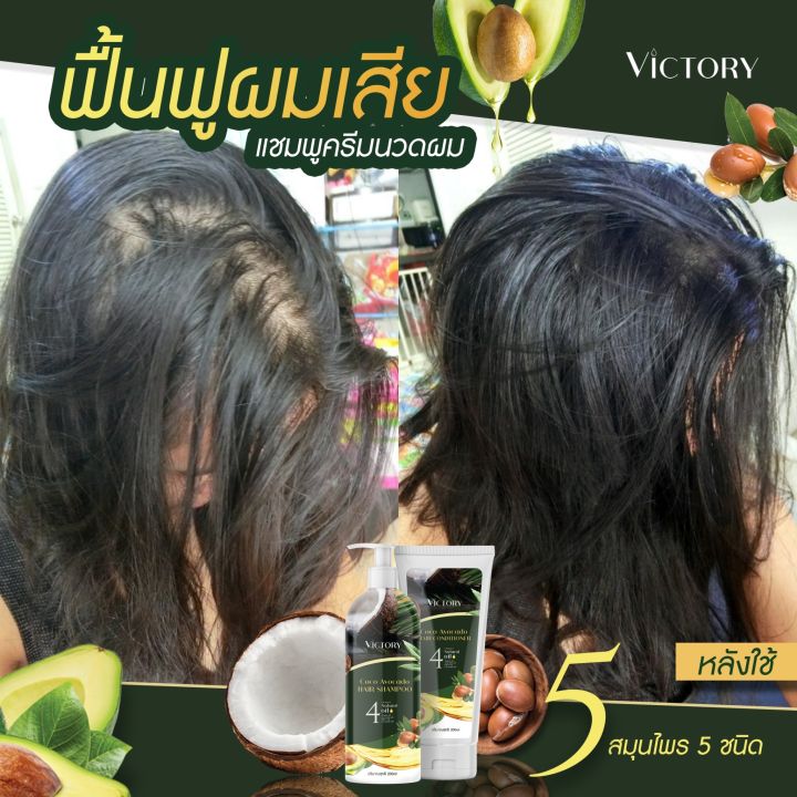 ชื้อ1ฟรี-1-เซรั่ม-วิคตอรี่-victory-hair-shampoo-เซรั่มป้องกันผมขาดหลุดร่วง-ผมแห้งเสีย-ผมแตกปลาย-1-แถม-1