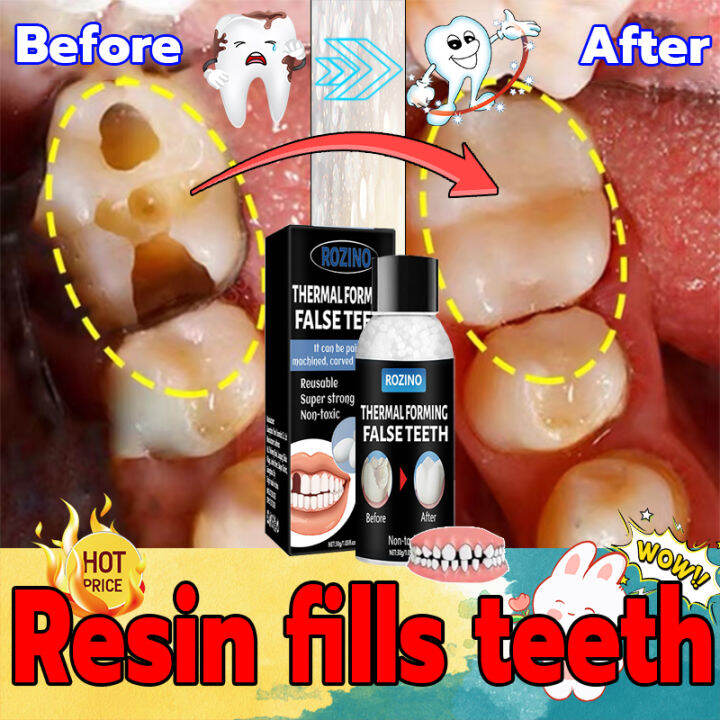 【Hot Sale】Temporary Tooth Repair Kit Teeth And Gaps FalseTeeth Solid Glue Fillings Restorative