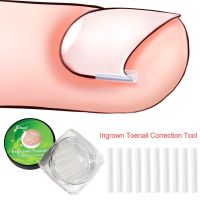 10pcs Ingrown Toenail Correction Tool Ingrown Toe Nail Treatment Elastic Patch Sticker Straightening Clip Brace Pedicure Tool