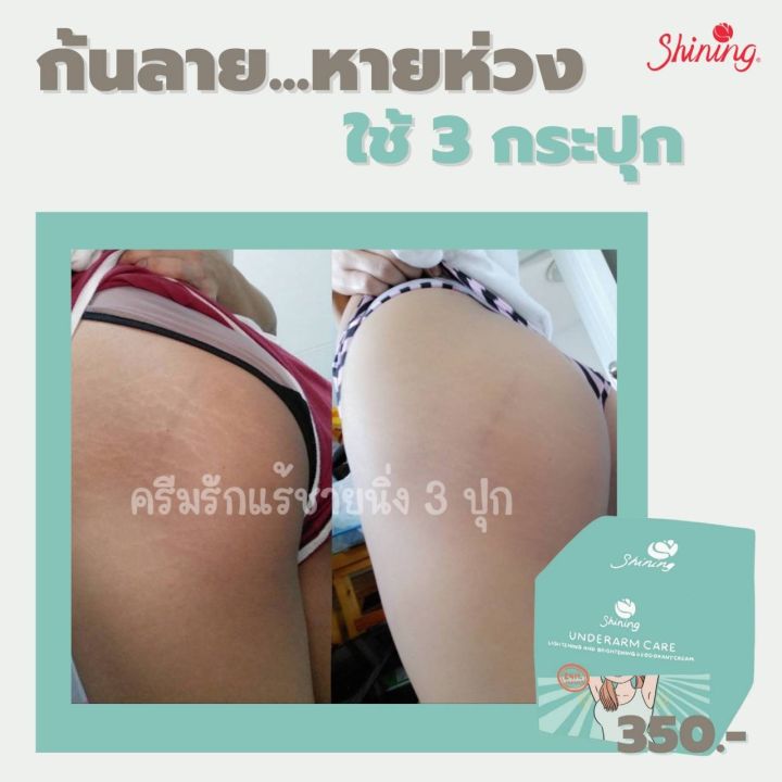 underarm-care-cream-ของแท้-ครีมรักแร้ขาว-shining-ครีมรักแร้ชายนิ่ง-ขนาด-50-กรัม-รักแร้ขาว-ลดตุ่มหยังไก่-บอกลาผิวคล้ำเสีย-ทั่วเรือนร่าง