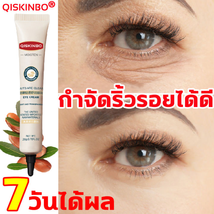 qiskinbo-ครีมถุงใต้ตา-20g-อายครีม-ครีมลดถุงใต้ตา-ครีมลบรอยตีนกา-คลีมลดถุงใต้ตา-บำรุงรอบดวงตา-แก้ใต้ตาคล้ำ-ครีมบำรุงรอบดวงตา-ครีมทาใต้ตา-ครีมทารอบดวงตา-อายครีมบำรุงตา-ขอบตาดำ-รอยตีนกา-ครีมแก้ขอบตาดำ-ey