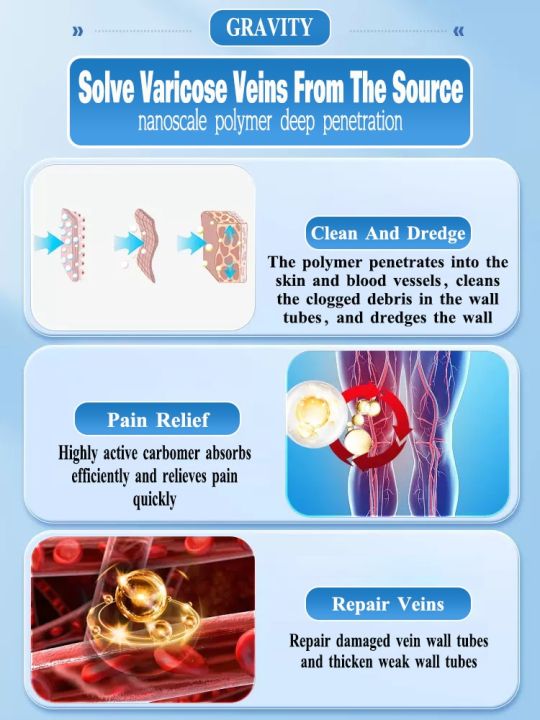 ครีมทาเส้นเลือดขอดกำจัด-vasculitis-ขาแมงมุม-phlebitis-ครีมแมงมุมเส้นเลือดขอดสำหรับเส้นเลือดขอด