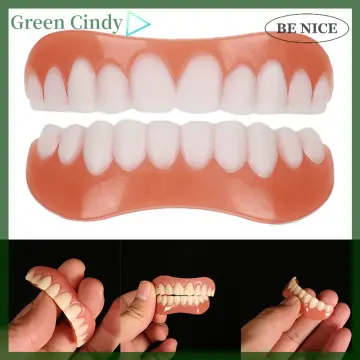 Carillas dentales - Rodium Dental