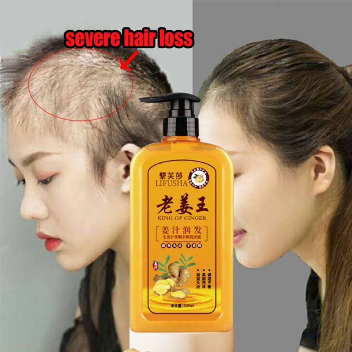 500ml Ginger Shampoo Anti Hair Loss Herbal Ginger Extract Shampoo Hair Grower For Women 3900