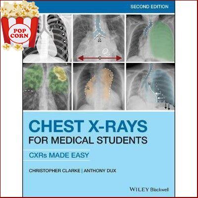 จัดส่งฟรี *** Chest X-Rays for Medical Students : CXRs Made Easy, 2ed - 9781119504153