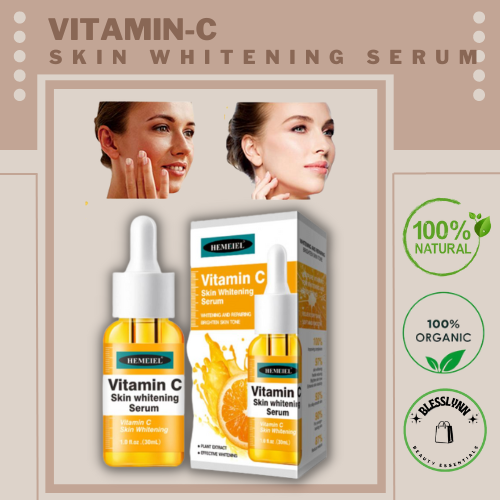 Vitamin C Serum/Melasma and Pekas Remover/Dark Spots/Whitening