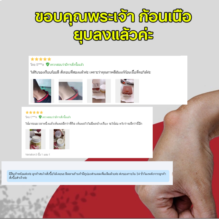 lipoma-removal-cream-ครีมก้อนเนื้องอกไขมัน-สมุนไพรกำจัด-ก้อนเนื้อใต้ผิวหนัง-ก้อนซีสต์-30g-ก้อนไขมันแข็ง-เนื้องอกไขมัน