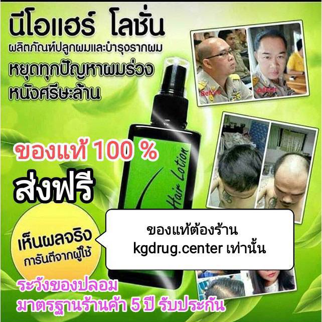 ของแท้-โปรโมชั่น-5-แถม-1-neo-hair-lotion-แถมฟรี-roller-ส่งด่วนทุกวัน-ของแท้-100-นีโอแฮร์โลชั่น-neohair-ส่งตรงจากโรงงาน