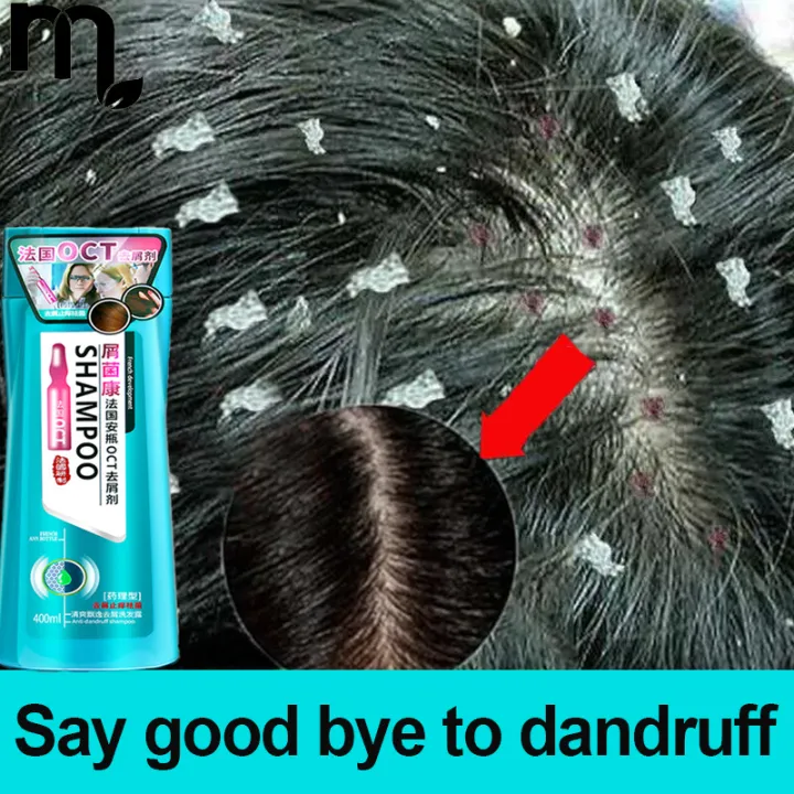 France OCT dandruff remover shampoo Removal Mites Shampoo Anti-itch shampoo  Moisturize hair and leave fragrance