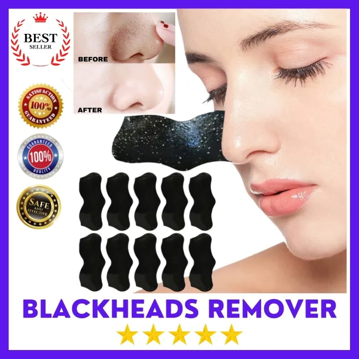 Original Black Head Remover Pantanggal ng blackheads at whiteheads
