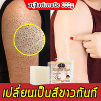 สบู่ผิวขาว สบู่ไวท์เทนนิ่งถาวร สบู่ผิวขาว 100g สบู่แองเจิลปรับปรุงผิว สบู่หน้าขาวใส สบู่ก้อน สบู่สูตรเฉพาะ สบู่ไวท์เทนนิ่ง ลบจุดด่