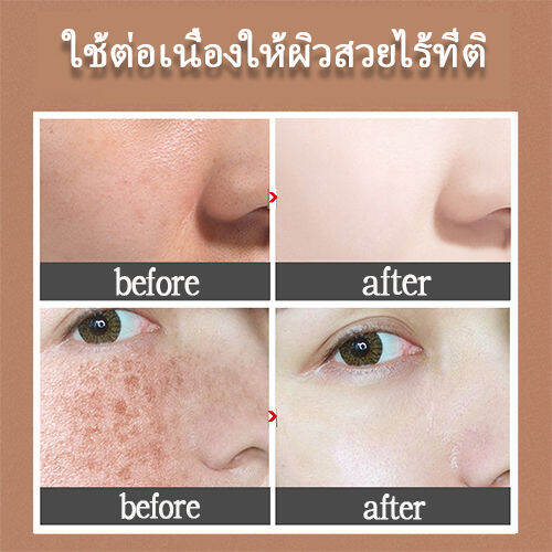 hemeiel-ครีมแก้ฝ้า-กระ-ครีมหน้าขาวใส-เซรั่มหน้าใสvit-c-ครีมรักษาฝ้า-30g