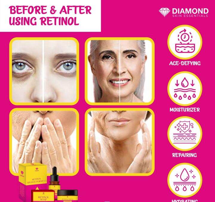 Retinol Advance Formula ( Anti Aging Skincare) Lazada PH