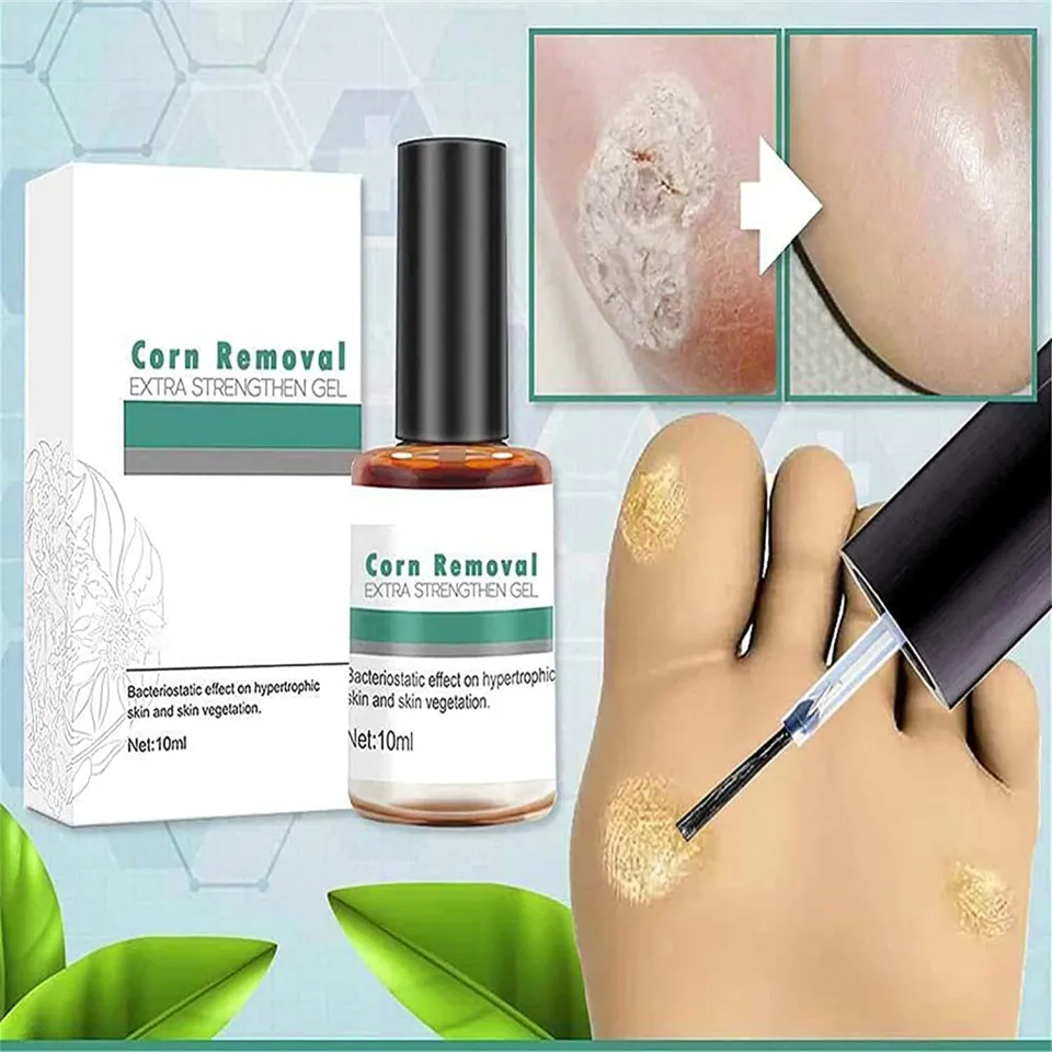 Foot Corn Removal,Extra Strengthen Gel Quick Corn Remover Liquid