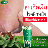 ?การันตี? ครีมทารา ครีมพลูคาว 40ml. สมุนไพรแก้สะเก็ดเงิน กลาก เกลื้อน ผื่นคัน พลูคาว สมุนไพร ยาทาสังคัง แก้สังคัง ยาทากากเกลื้อน