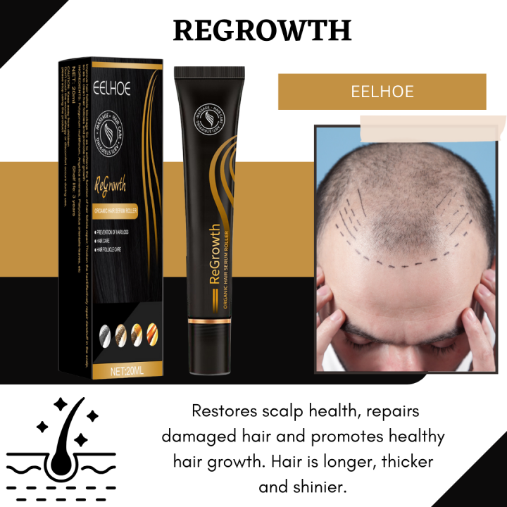 Authentic Regrowth Herbal Hair Growth Essence Hair Loss Treatment Hair Regrowth Serum Prevent