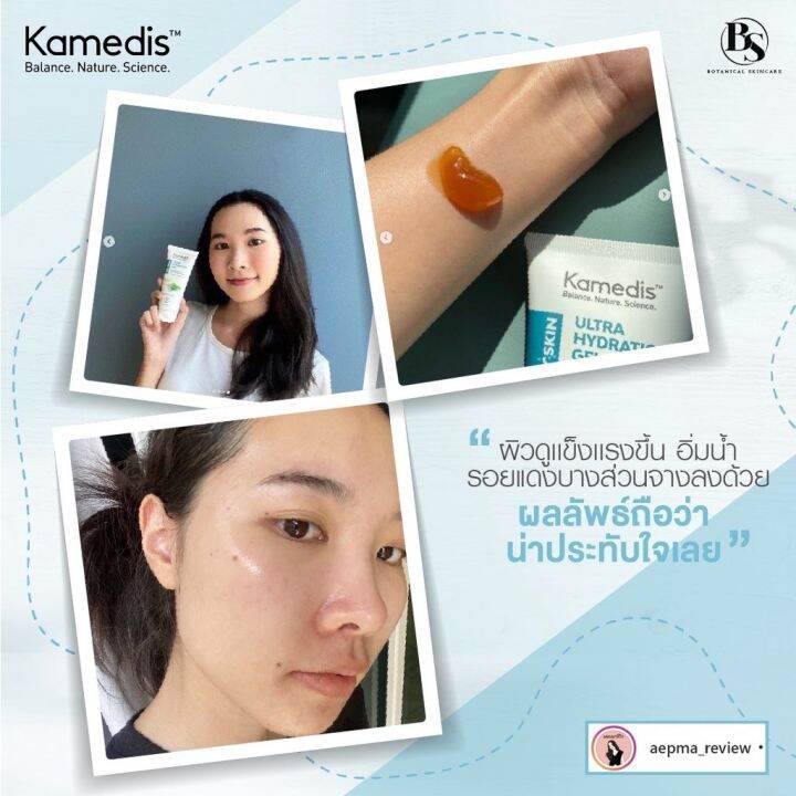 มอยเจอไรเซอร์เจลสำหรับ-ผิวแห้ง-ขาดน้ำ-kamedis-dry-skin-ultra-hydration-gel-100ml