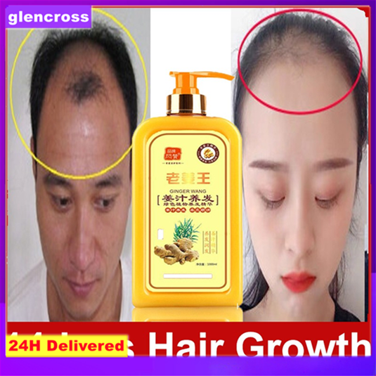 【Ready Stock】Ginger Hair Shampoo Conditioner Anti Hair Loss 1000ml Oil