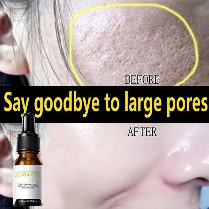 Pore Tightening Serum Blackheads Remover[ALL NATURAL, Pore Minimizer