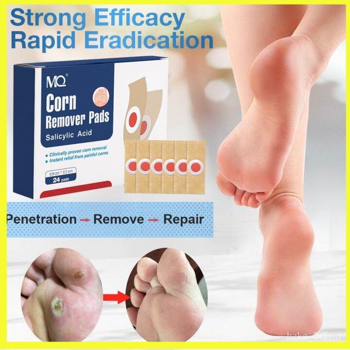 24Pcs Feet Corns/ Warts Removal Patch Pain Relief Remover Feet Callus