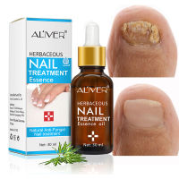 Nail Fungal Treatment Feet Care Essence Nail Foot Care Toe Nail Fungus Removal Gel Anti Infection Paronychia Onychomycosis 30ML