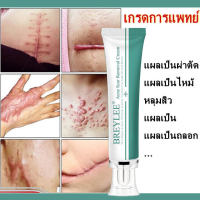 MAFFICK  Breylee Scar Cream ครีมรักษารอยแผลเป็นทุกประเภท ครีมลบรอ ครีมลดรอยแผลเป็น ครีมต่อสู้แผลเป็น ครีมลบรอยแผลเป็น ครีมทาแผลเป็นทั่วร่