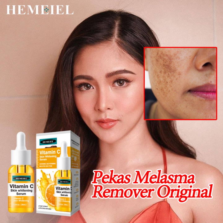 HEMEIEL Vitamin C Serum/Melasma and Pekas Remover/Dark Spots/Whitening ...