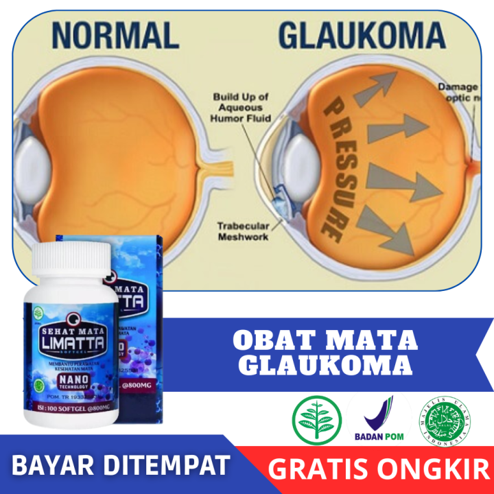 Obat Glaukoma, Vitamin Saraf Mata, Mengobati Sakit Mata, Obat Herbal ...