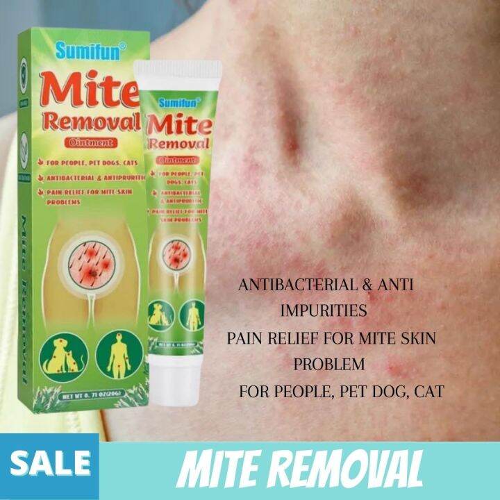 SUPER SALE!! Mite Bite Ointment Remove Scabies Pubic Lice Ointment Skin