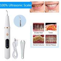 ZZOOI Ultrasonic Calculus Remover Dental Scaling Electric Portable Scaler Sonic Smoke Stains Tartar Plaque Teeth White Home