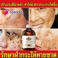 DSIUAN เซรั่มทาฝ้า 100ml ครีมแก้ฝ้าลึก ไวท์เทนนิ่งและลดกระ ครีมบำรุงผิวหน้า ครีมลดฝ้า ครีมทาฝ้าหนาๆ ครีมทาฝ้าลึก ครีมหน้าขาวใส ครีมทาฝ้ากระ ครีมฝ้ากระ ครีมทาหน้าขาว ครีมกระไวท์เทนนิ่ง ไวท์เทนนิ่งครีม ครีมไวท์เทนนิ่ง