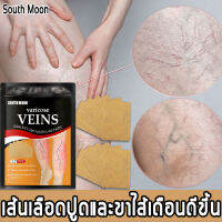 [สูตรใหม่] South Moon Varicose veins เส้นเลือดขอด แผ่นแปะเส้นเลือดขอด แท้ 100% จะทำให้การอักเสบของหลอดเลือดดำลดลง และทำให้ลิ้นในหลอดเลือดดำกลับมาเป็นปกติได้ ป้องกันหรือลดอาการบวม แผ่นเปาะเส้นเลือดขอด