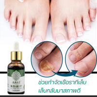 【ของแท้】เซรั่มเล็บ เซรั่มซ่อมแซมเล็บ เชื้อราที่เล็บ เล็บพัง เล็บขบ เซรั่มบำรุงเล็บ ไม่ทำร้ายเล็บดี ฆ่าเชื้อราที่เล็บ ยับยั้งเชื้อรา