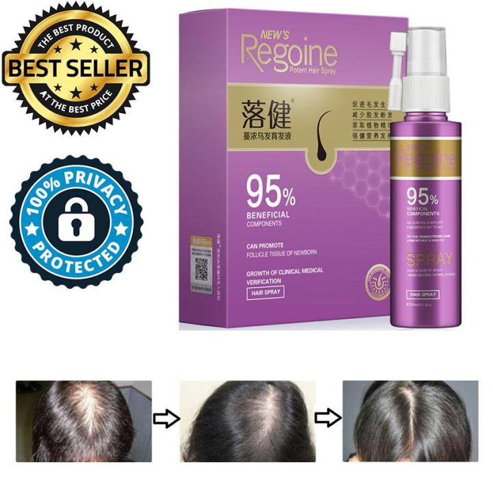 MAZE TRADING] New's Regoine Female Hair Spray Hair Loss Treatment for  Repair and increase Nutrient Absorption and accelerate hair growth HG-2 |  Lazada