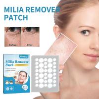 144 Patches Skin Tag Acne Remover Patch Pimple Blemish Care Repair Skin Stickers R0P3