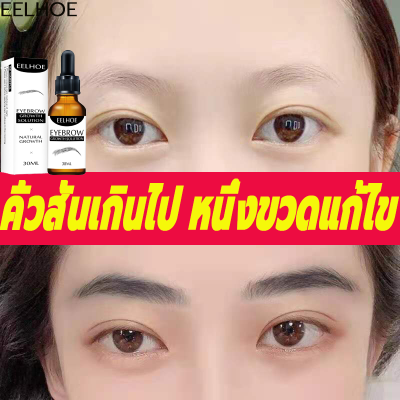 EELHOEเซรั่มปลูกคิ้ว เชรั่มปลูกคิ้ว  10 ml เซรั่มขนตายาว การเติบโตของคิ้ว คิ้วธรรมชาติ การเจริญเติบโตของคิ้วจริง เซรั่มบำรุงและเพิ่มความยาวขนตา เซรั่มบำรุงขนตา