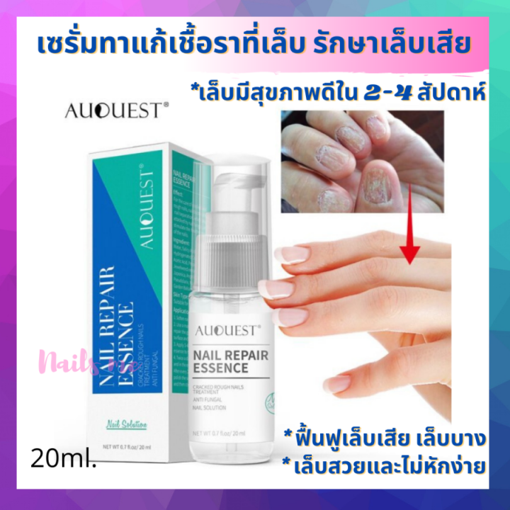 ยาทาแก้เชื้อราที่เล็บ บำรุงเล็บเสีย เล็บบาง น้ำยารักษาเล็บ เซรั่มรักษา