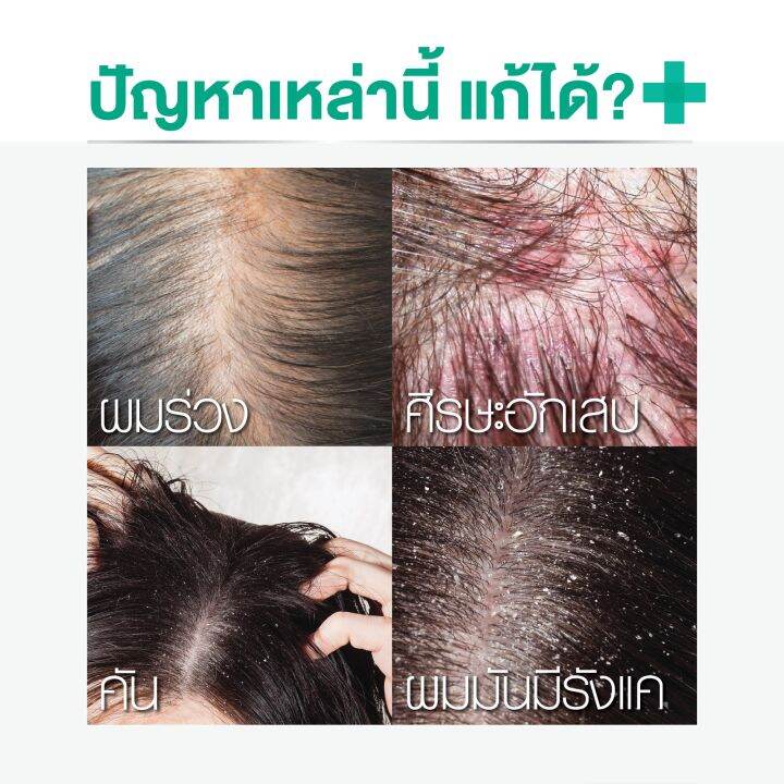 แพ็ค-2-smooth-e-purifying-anti-hair-loss-shampoo-100ml-แชมพู-บำรุงผม-หนังศีรษะ-ขจัดรังแค-ต้านเชื้อรา-สารสกัดธรรมชาติ-ลดคัน-ฟื้นฟูเส้นผม