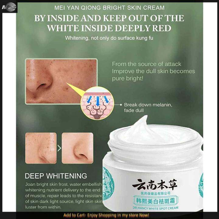 Yunnan Herbal Whitening Freckle Cream G Japanese Melasma Cream