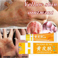 Yellow skin ointment antibacterial and antipruritic anti-peeling red swelling anti-itching cream anti-itching antibacterial repair peeling whole body men and women can use anti-itching cream