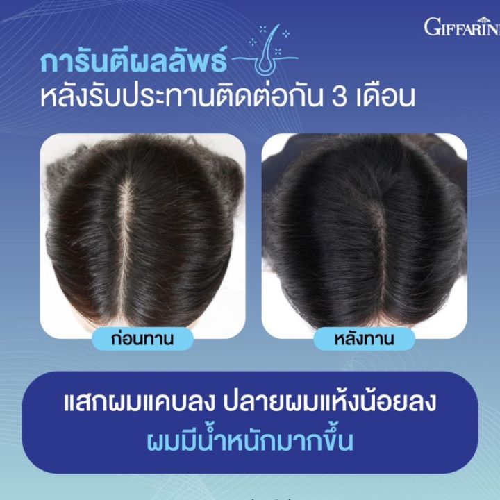 วิตามินผม-กิฟฟารีน-ไบโอติน-เอช-พลัส-giffarine-biotin-h-plus-ลดผมขาดหลุดร่วง-เพิ่มผมงอกใหม่-ผมแข็งแรงสุขภาพดี-30-แคปซูล