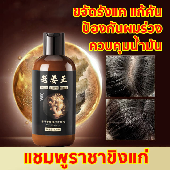 thai-พร้อมส่ง-แชมพูเร่งผมยาว-แชมพูแก้ผมร่วง-แชมพูขิง-สูตรน้ำขิง-ปลูกผมอย่างอ่อนโยน-บำรุงรากผม-ผมแข็งแรง-ป้องกันรังแคแก้คันและป้องกันผมร่วง-แชมพูปลูกผม-แชมพูปลูกผมดก-แชพูแก้ผมร่วง-ยาสระผมขิง-แชมพูขิงเพ