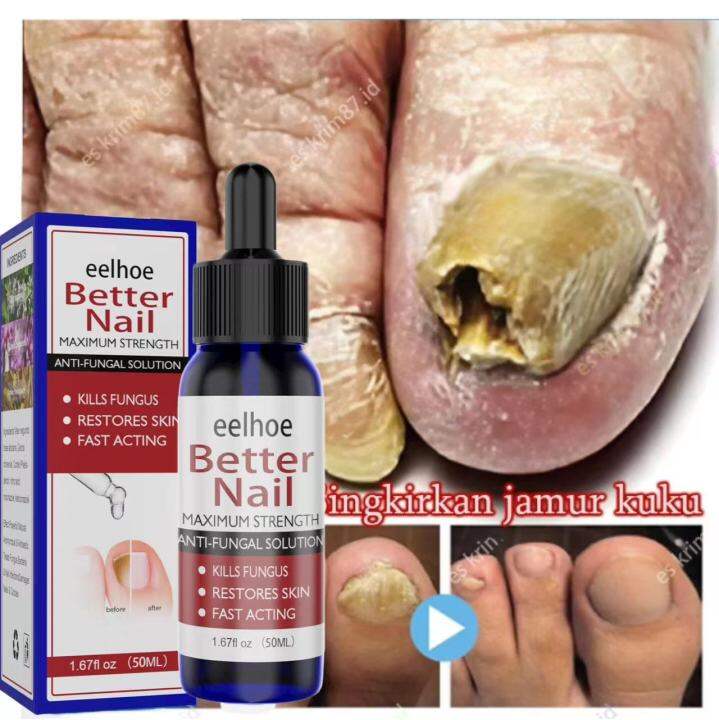 Eelhoe Nail Repair Essence Nails Serum Perawatan Kuku Tangan Kaki