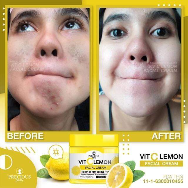 【COD】 VIT C LEMON FACIAL CREAM 60g by PRECIOUS SKIN ON HAND READY TO
